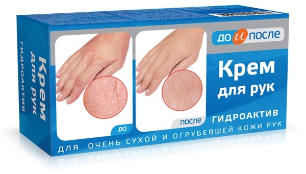 До и после крем для рук гидроактивный для сухой кожи 100мл
